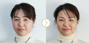 ビフォーアフター写真