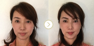 ビフォーアフター写真