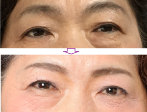50代からの眉の描き方｜若見えを叶える美眉テクニック