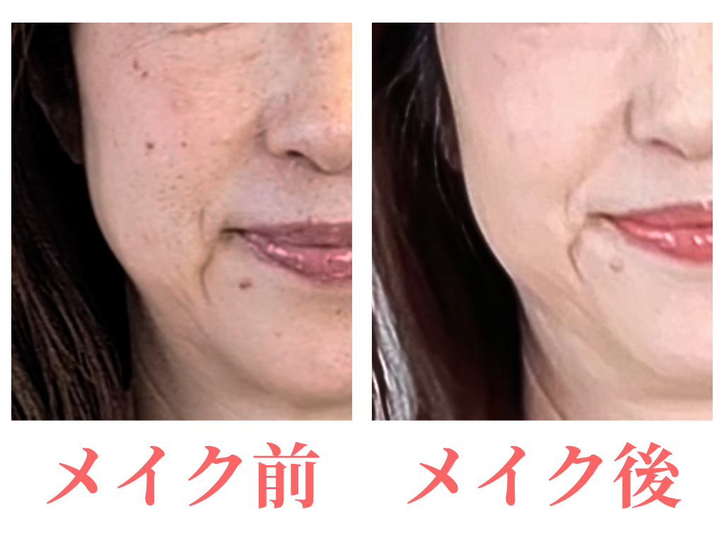 50代　シミ増えた