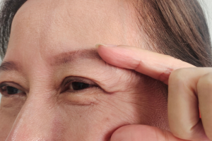 まつ毛が薄く、短くなる